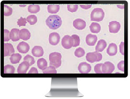 ��������� ������������������ ����������� �����-�2: �������������� ���� ��� � ������