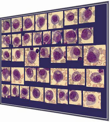 ��������� ������������ ����������� ����� �� 100000 ������