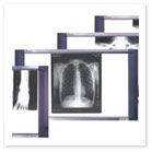 Негатоскопы для просмотра рентгенограмм