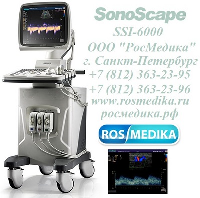  SonoScape SSI-6000
