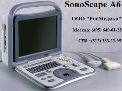   SonoScape A6.  .       "". .  : (495) 640-61-28. .  .: (812) 363-23-95.