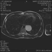 ��������� ����� �����������